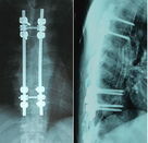 De Filmblauw van de röntgenstraal Droog Medisch Weergave 8 x 10 Duim voor Agfa/Fuji