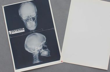 Witte Medische Document de Film Waterdichte Hoge Scherpte van de Borströntgenstraal