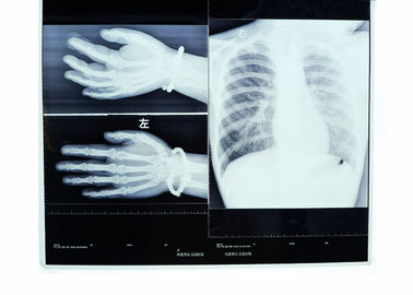 10 x 14inch drogen Medische Röntgenstraalfilms voor Fuji 3000/2000/1000